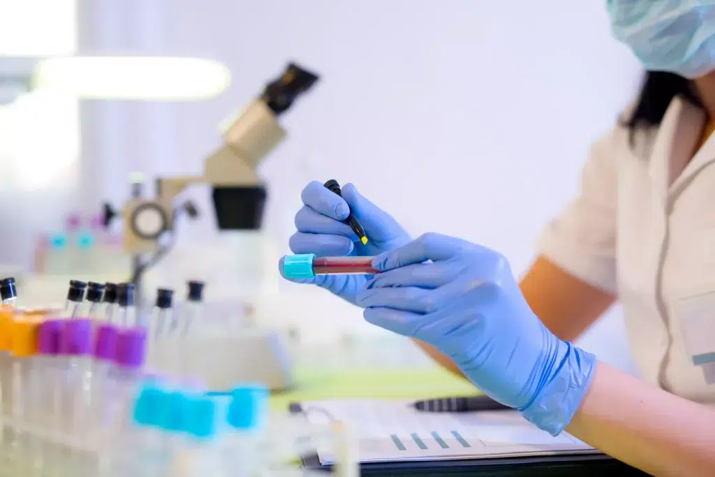 Improving the life of HIV patients with global change-makers